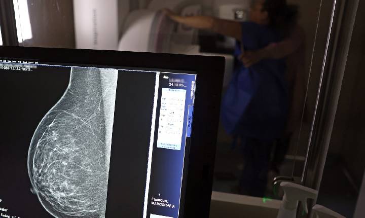 Médicos lançam guia para evitar recusa de mamografia digital