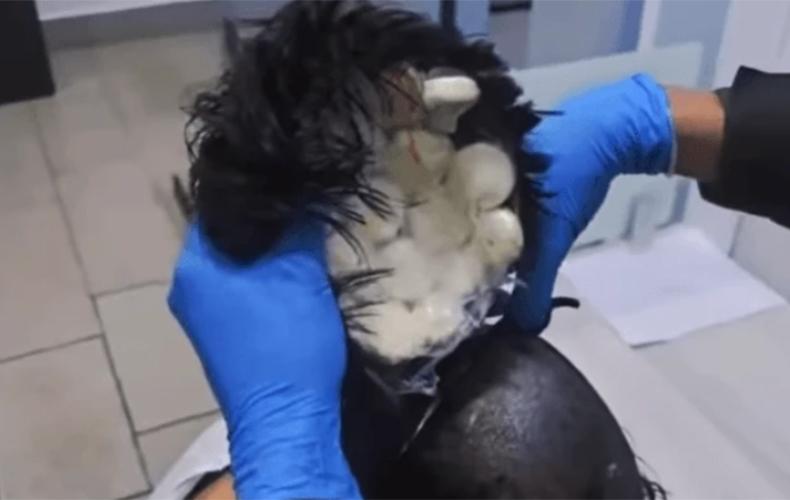 Criatividade do crime: Homem tenta entrar em avião com 19 cápsulas de cocaína escondidas na peruca