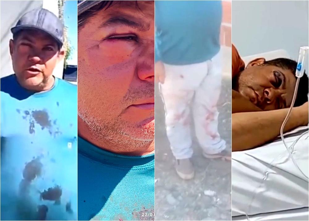 Servidor da Prefeitura de São Raimundo Nonato é espancado por ex-vereador